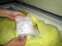 Ảnh TP.HCM: Bảo quản xương sọ để cấy ghép