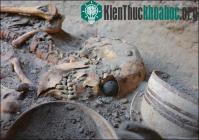 Ảnh Mắt nhân tạo 4.800 tuổi được tìm thấy ở Iran