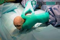Ảnh Khỉ sơ sinh có gương mặt giống Chúa tể Hắc ám Voldemort