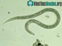 Ảnh Khoa học giải mã thành công bộ gene của giun móc