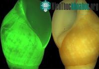 Ảnh Những đặc điểm kỳ lạ của ốc sên