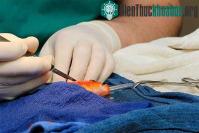 Ảnh Bác sĩ Australia phẫu thuật u não cho cá vàng