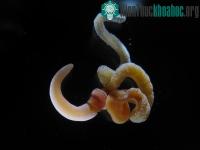 Ảnh Não người giống não giun?