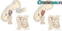 Ảnh Kháng sinh ảnh hưởng nghiêm trọng đến sự phát triển của trẻ nhỏ