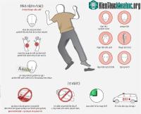 Ảnh Làm thế nào nhận biết một người đang bị đột quỵ