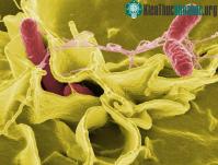 Ảnh Cảnh báo: Dưa leo nhiễm khuẩn salmonella chết người đang ngày càng lan rộng