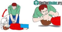 Ảnh 9 kỹ năng cấp cứu cơ bản ai cũng nên biết