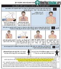 Ảnh Cách xử trí khi bị sốc phản vệ do tiêm vắc xin