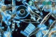 Ảnh Dùng tảo biến đổi gene làm thuốc chữa ung thư