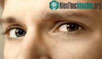 Ảnh Tại sao người có hai màu mắt khác nhau?