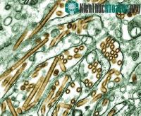 Ảnh H5N1 có thể lây qua không khí