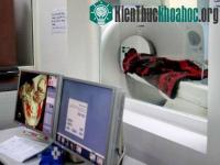 Ảnh Chụp CT, trẻ có nguy cơ ung thư não cao