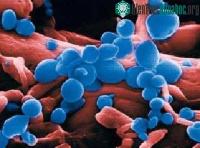 Ảnh Tỉ lệ mắc cúm A/H5N1 năm 2010 tăng bất thường