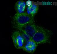 Ảnh Cây thường xanh và bệnh ung thư vú
