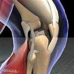 Ảnh Cách nhận biết và xử lý sai khớp