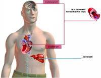 Ảnh Rối loạn mỡ máu điều trị có thể không dùng thuốc