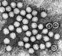 Ảnh Ứng dụng kỹ thuật PCR để chẩn đoán viêm não, viêm màng não