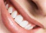 Ảnh Bệnh chảy máu chân răng