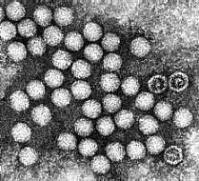 Ảnh Ninh Thuận: thêm 20 bệnh nhi nhiễm virus đường tiêu hóa