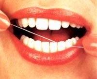 Ảnh Xỉa răng lung tung gây viêm lợi