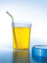 Ảnh Nước tiểu có phải là thuốc chữa bệnh?
