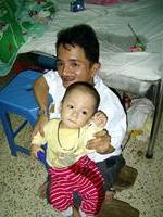 Ảnh Bệnh xương thủy tinh