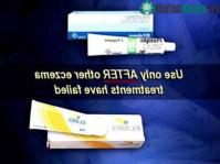 Ảnh Cảnh báo nguy cơ ung thư khi dùng Elidel và Protopic
