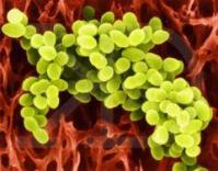 Ảnh Chống AIDS bằng... sữa chua