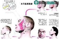 Ảnh Kinh nghiệm cấy ghép mặt từ Trung Quốc