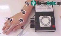 Ảnh Châm cứu bằng ... ánh sáng