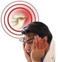 Ảnh Bệnh loạn năng khớp hàm thái dương