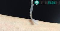 Ảnh Phát minh giúp người bị tiểu đường không cần phải chú ý tiêm insulin thường xuyên