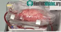 Ảnh Thiết bị duy trì “sự sống” nội tạng bên ngoài cơ thể