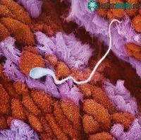 Ảnh Tìm hiểu quá trình thụ thai ở người qua hình ảnh