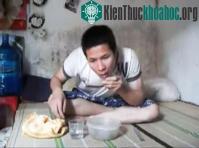 Ảnh Nam sinh viên nuốt bóng điện thủy tinh