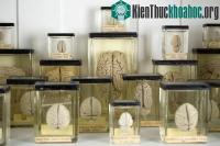 Ảnh 100 bộ não biến mất một cách bí ẩn