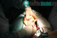 Ảnh Bác sĩ người Việt thực hiện ca ghép tim thành công