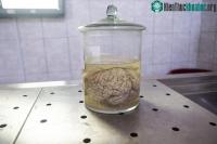 Ảnh Quân đội Mỹ đầu tư 65 triệu USD để nghiên cứu phương pháp cấy ghép não