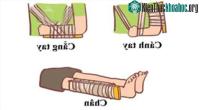 Ảnh Hướng dẫn cách sơ cứu đúng cách cho trẻ bị gãy xương