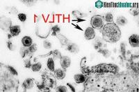 Ảnh Virus cổ xưa có "họ hàng với HIV" đã đột nhiên trỗi dậy