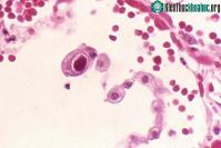 Ảnh Tìm ra loại virus có thể giúp tăng cường hệ miễn dịch cho người cao tuổi