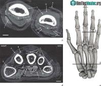 Ảnh Kỹ thuật chụp ảnh đã hé lộ từng mạch máu bên trong xác ướp