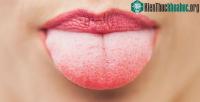 Ảnh Dấu hiệu phổ biến cảnh báo bệnh ung thư lưỡi