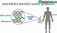 Ảnh Ung thư không cần xạ trị nhờ vào xét nghiệm máu sau phẫu thuật