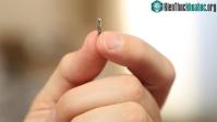 Ảnh Theo dõi sự di chuyển của khối u bằng hệ thống định vị trong cơ thể