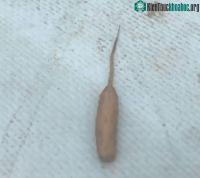 Ảnh Giòi đuôi chuột xuất hiện tại hồ Bolac - Australia