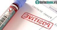 Ảnh Sau gần 100 năm vi rút HIV vẫn ám ảnh nhân loại nhưng tại sao chúng lại khó đối phó đến vậy?