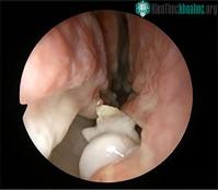 Ảnh Kì lạ với người đàn ông có răng mọc… trong mũi
