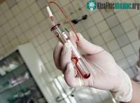 Ảnh Thiết bị phát hiện vi khuẩn trong cơ thể trong vòng vài phút