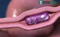 Ảnh Giới thiệu công nghệ tiêm không đau bằng cách đâm kim thẳng vào  thành ruột